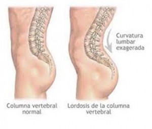 columnaVertebralNormal